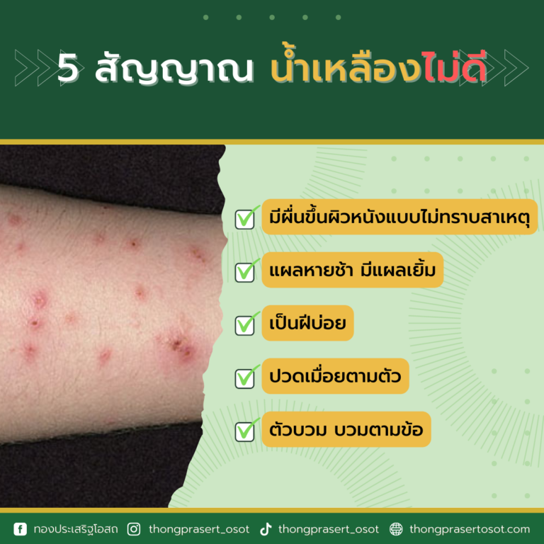 จีเฮิร์บ - โรงงานจีเฮิรฺ์บ - ทองประเสริฐโอสถ